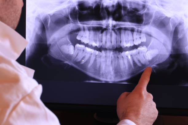 Best Emergency Dental Care for Broken or Chipped Teeth in South Cleveland, TN