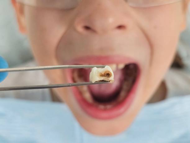 Best Weekend Emergency Dentist in South Cleveland, TN